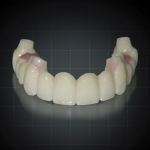 Occlusal Considerations in Full-Arch Implant-Supported Fixed Prosthetics eBook Thumbnail