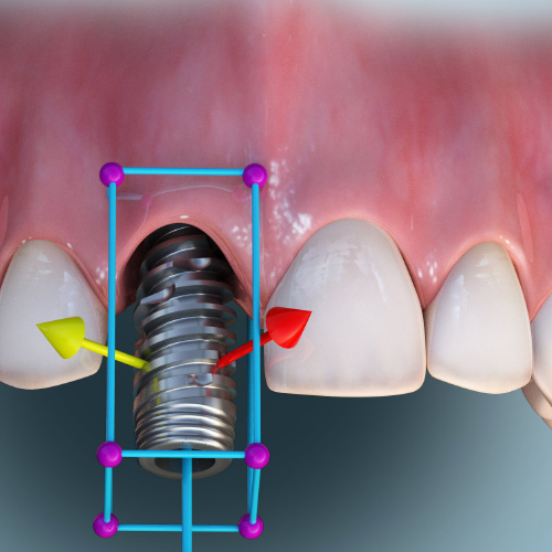 CBCT for Implant Dentistry Treatment Planning eBook Thumbnail
