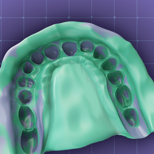 Mastering the Art of Dental Impressions eBook Thumbnail