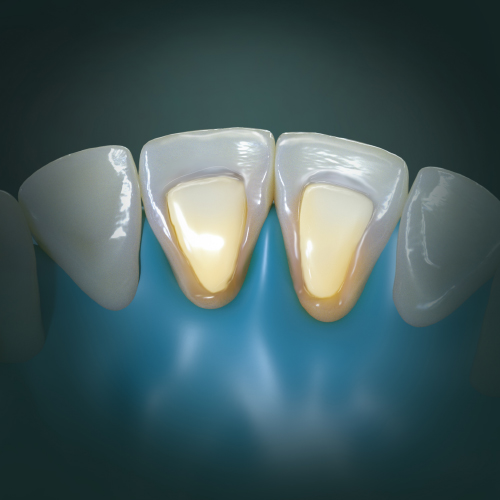 Restorative Dentistry Alternatives eBook Thumbnail