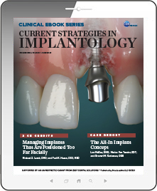 Current Strategies in Implantology eBook Thumbnail