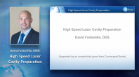 High-Speed Laser Cavity Preparation Webinar Thumbnail