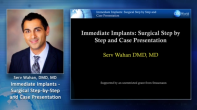 Immediate Implants: Surgical Step by Step and Case Presentation Webinar Thumbnail