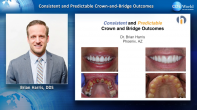 Consistent and Predictable Crown and Bridge Outcomes Webinar Thumbnail