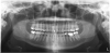 Figure 2. Panoramic radiographs are options when intraoral radiography is impractical or additional diagnostic information is required.