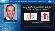 Bone Grafts and Extraction Sockets: Conflicts or Companionship? Webinar Thumbnail