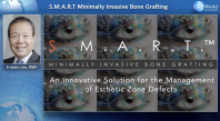 S.M.A.R.T. Minimally Invasive Bone Grafting: An Innovative Solution For The Management Of Esthetic Zone Defects Webinar Thumbnail