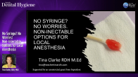 No Syringe? No Worries! Non-Injectable Options for Local Anesthesia Webinar Thumbnail