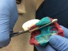 Fig 3. Trimming back an overextended border on an impression with scissors and wearing gloves. (Courtesy of First Impression Dental Laboratory, Atlanta, GA)