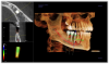 Figure 1. A CBCT scan used in conjunction with implant placement software can help guide successful treatment planning and surgical outcomes.