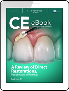 A Review of Direct Restorations, Their Applications, and Possibilities eBook Thumbnail