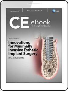 Innovations for Minimally Invasive Esthetic Implant Surgery eBook Thumbnail