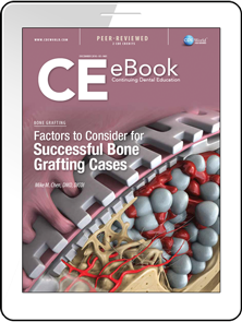 Factors to Consider for Successful Bone Grafting Cases eBook Thumbnail