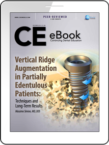 Vertical Ridge Augmentation in Partially Edentulous Patients: Techniques and Long-Term Results eBook Thumbnail