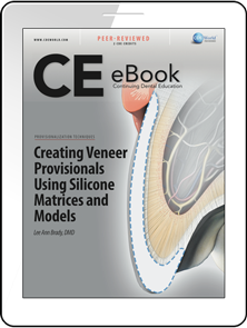 Creating Veneer Provisionals Using Silicone Matrices and Models eBook Thumbnail