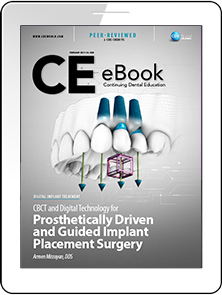 CBCT and Digital Technology for Prosthetically Driven and Guided Implant Placement Surgery eBook Thumbnail