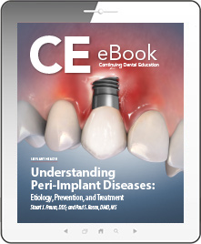 Understanding Peri-Implant Diseases: Etiology, Prevention, and Treatment eBook Thumbnail