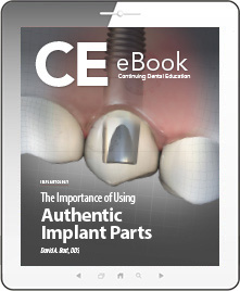 The Importance of Using Authentic Implant Parts eBook Thumbnail
