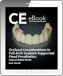 Occlusal Considerations in Full-Arch Implant-Supported Fixed Prosthetics eBook Thumbnail