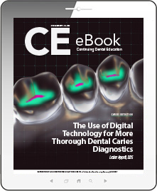 The Use of Digital Technology for More Thorough Dental Caries Diagnostics eBook Thumbnail