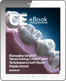 Managing Gingival Tissue During Crown Cases: Techniques in Soft-Tissue Displacement eBook Thumbnail
