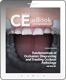 Fundamentals of Occlusion: Diagnosing and Treating Occlusal Pathology eBook Thumbnail