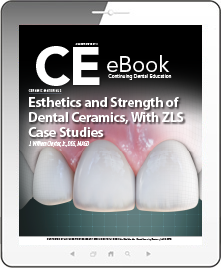 Esthetics and Strength of Dental Ceramics, With ZLS Case Studies eBook Thumbnail