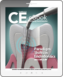 Paradigm Shifts in Endodontics eBook Thumbnail