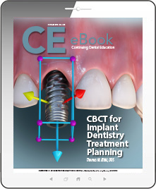 CBCT for Implant Dentistry Treatment Planning eBook Thumbnail