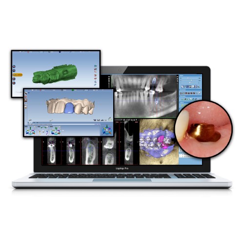 CAD/CAM: The Evolution of a Niche Product Into an Integral Part of Dentistry eBook Thumbnail