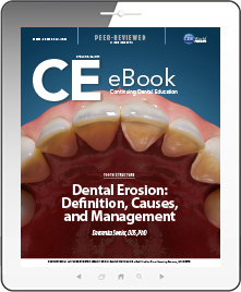 Dental Erosion: Definition, Causes, and Management eBook Thumbnail