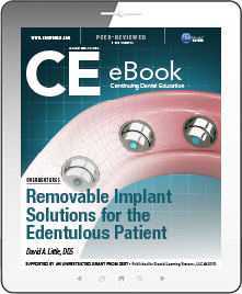 Removable Implant Solutions for the Edentulous Patient eBook Thumbnail
