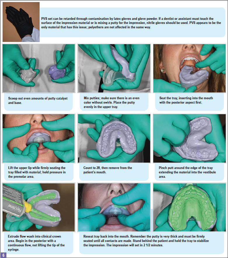 Orthodontist using dental putty to make teeth impressions of a