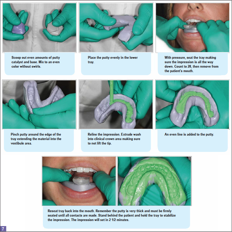 Step-by-Step Master's Guide to Taking Dental Impressions