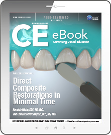 Direct Composite Restorations in Minimal Time eBook Thumbnail