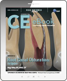 Root Canal Obturation: An Update eBook Thumbnail