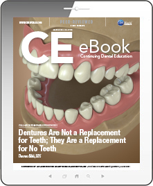 Dentures Are Not a Replacement for Teeth; They Are a Replacement for No Teeth eBook Thumbnail