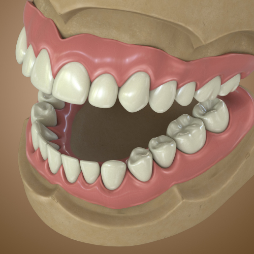 Dentures Are Not a Replacement for Teeth; They Are a Replacement for No Teeth eBook Thumbnail