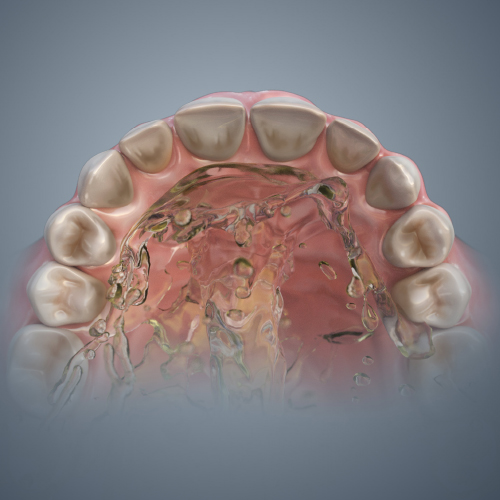 Dental Erosion: Etiology, Diagnosis, and Management eBook Thumbnail