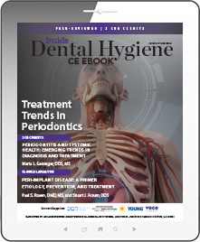 Treatment Trends in Periodontics eBook Thumbnail