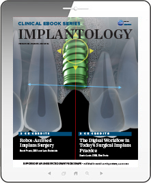 Implantology eBook Thumbnail