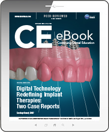 Digital Technology Redefining Implant Therapies: Two Case Reports eBook Thumbnail