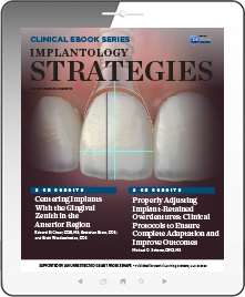 Implantology Strategies eBook Thumbnail