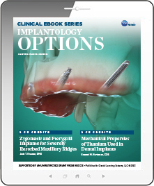 Implantology Options eBook Thumbnail