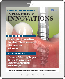 Implantology Innovations eBook Thumbnail