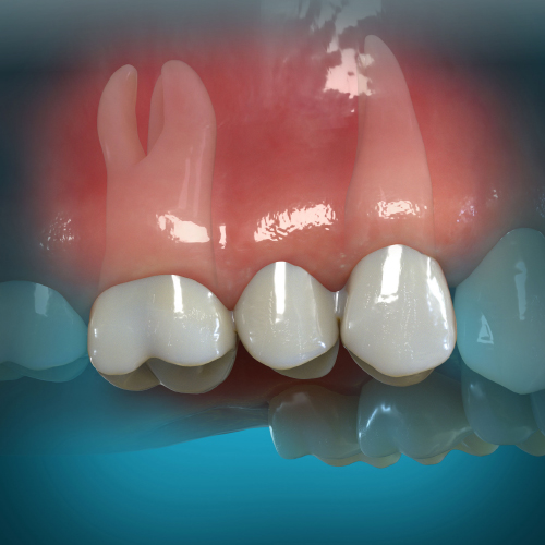 Restorative Dentistry Innovations eBook Thumbnail