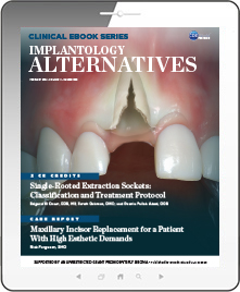 Implantology Alternatives eBook Thumbnail