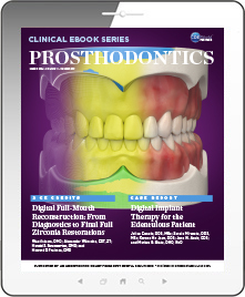 Prosthodontics eBook Thumbnail