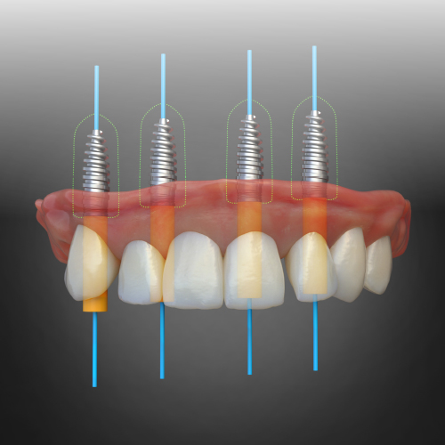 Digital Dentistry Innovations eBook Thumbnail