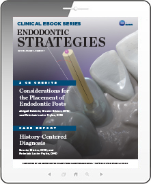 Endodontic Strategies eBook Thumbnail